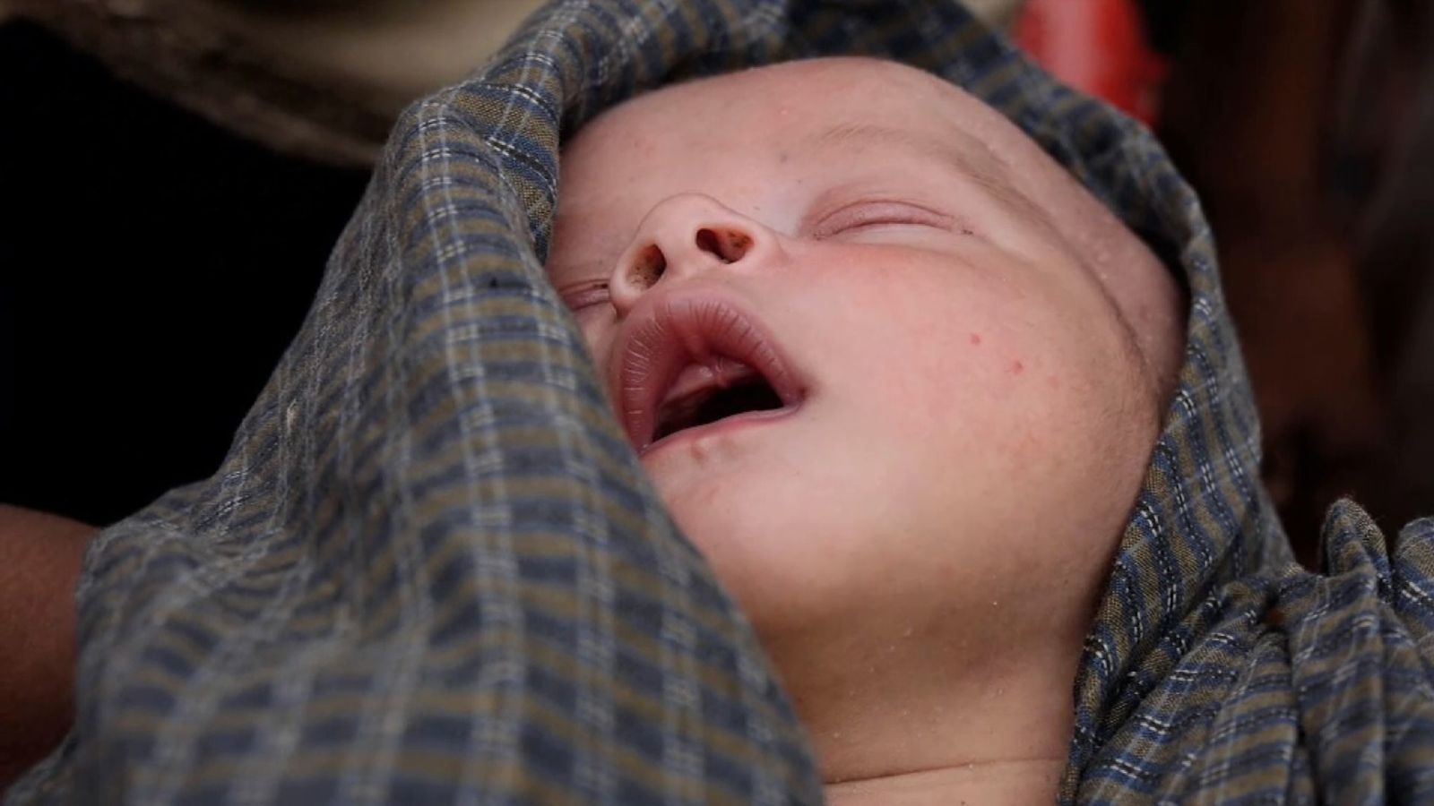  Ce bébé Rohingya de deux jours est désespérément malade 