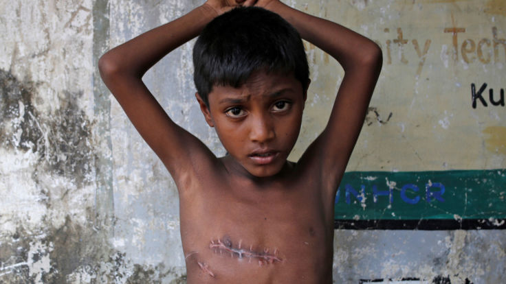  Mohammed Shoaib, 7 ans, a été blessé à la poitrine au Myanmar 