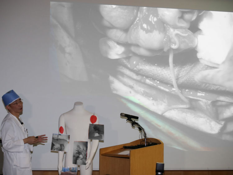  Lee Cook-jong, chirurgien, fait un exposé lors d'une conférence de presse dans un hôpital de Suwon, Corée du Sud, le 15 novembre 2017 