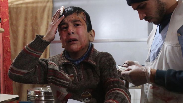  Ghaith, un jeune Syrien blessé de 12 ans, pleure alors qu'il reçoit un traitement à l'hôpital de Kafr Batna. pour les nouvelles de sa mère dans la salle d'opération 