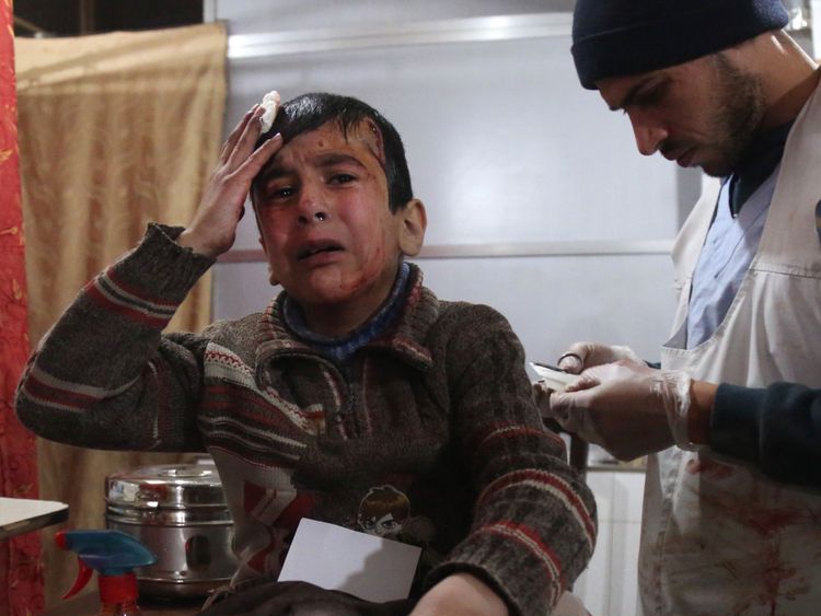  Ghaith, un garçon syrien blessé de 12 ans, pleure. reçoit un traitement dans un hôpital de fortune à Kafr Batna et attend des nouvelles de sa mère dans la salle d'opération 