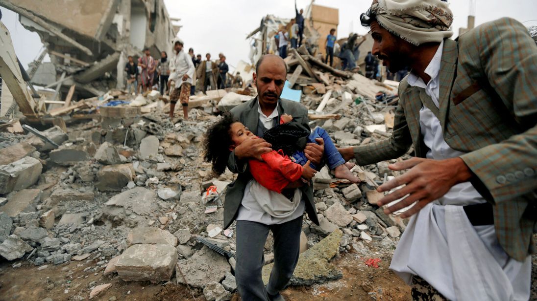 
 YEMEN-SECURITY / AIRSTRIKERTX3DFFQ26 août 2017Sanaa, YémenButhaina Muhammad Mansour, soupçonnée d'avoir quatre ou cinq ans, est assise sur un lit dans un hôpital après avoir survécu à un frappe aérienne qui a tué huit membres de sa famille à Sanaa. REUTERS / Khaled Abdullah 