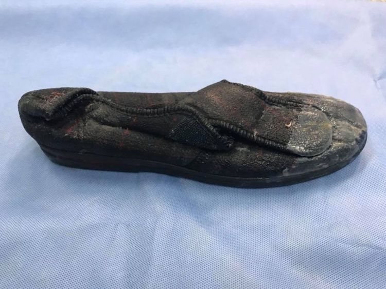  La pantoufle de l'homme après qu'elle ait été enlevée du serpent. Pic: Facebook / HerpVet 