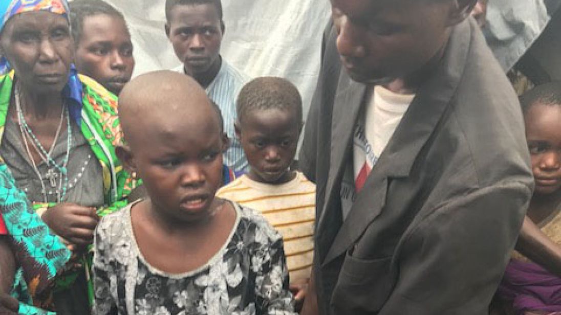  Mave, 11 ans, s'est enfui de deux miliciens mais ils l'ont rattrapé et lui ont piraté la tête et le cou 