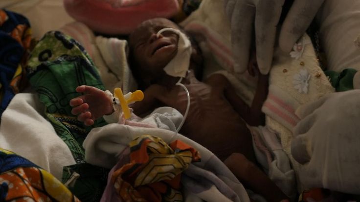  Le bébé est l'un des déplacés internes de la République Démocratique du Congo & # 39; 