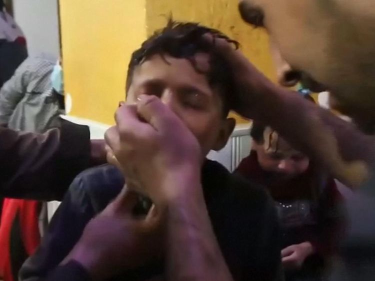  Un enfant est traité à la suite d'une attaque présumée d'armes chimiques à Douma, en Syrie. Pic: 