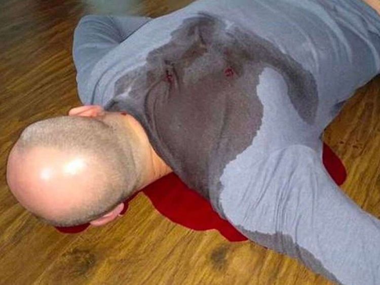  L'image d'Arkady Babchencko simulait la mort en utilisant du sang de cochon 