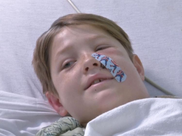 Les médecins croient que Xavier pourrait se remettre complètement de ses blessures. Pic: Réseau de nouvelles médicales
