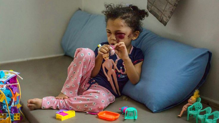 Buthaina, une fille de cinq ans victime d'une attaque aérienne présumée saoudienne