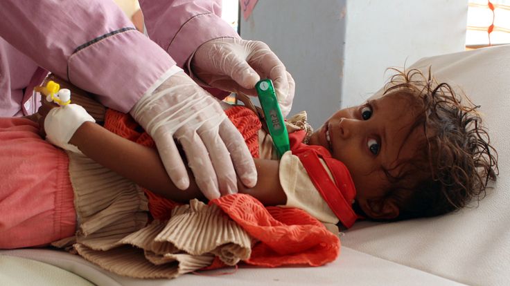 L'année dernière, un enfant yéménite soupçonné d'être infecté par le choléra est examiné