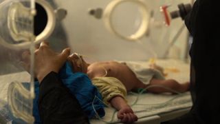 Au Yémen, de nombreux enfants meurent du manque de nourriture et de soins de santé.