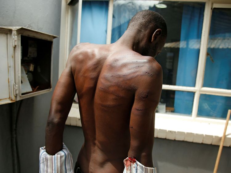   Un homme blessé arrêté est vu dans un hôpital après les manifestations à Harare