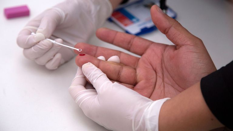 Un homme subit un test de dépistage rapide du VIH lors du défilé de la fierté gaie à Santiago le 23 juin 2018