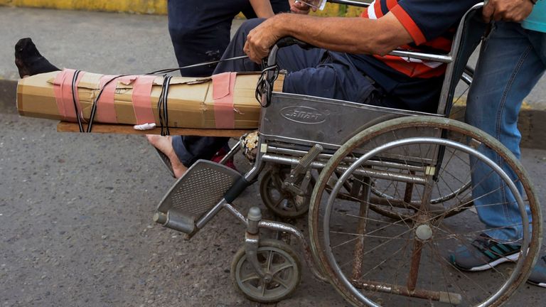 Un homme avec une attelle improvisée traverse le pont international Simon Bolivar à la frontière entre la ville colombienne de Cucuta et la Tachira vénézuélienne.