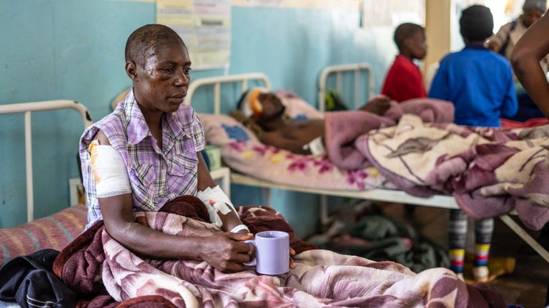 Louange Chipore, âgé de 31 ans, survivant du cyclone, est assis sur un lit d'hôpital à l'hôpital de district de Chimanimani Rural, dans la province de Manicaland, dans l'est du Zimbabwe, après que la région ait été touchée par le cyclone Idai. - Un cyclone qui a dévasté le Mozambique et le Zimbabwe a fait au moins 162 morts et de nombreux disparus. Le cyclone Idai s'est abattu sur le centre du Mozambique dans la nuit du 14 au 14 mars, avant de se diriger vers le Zimbabwe voisin, provoquant des inondations soudaines et des vents féroces, et emportant des routes