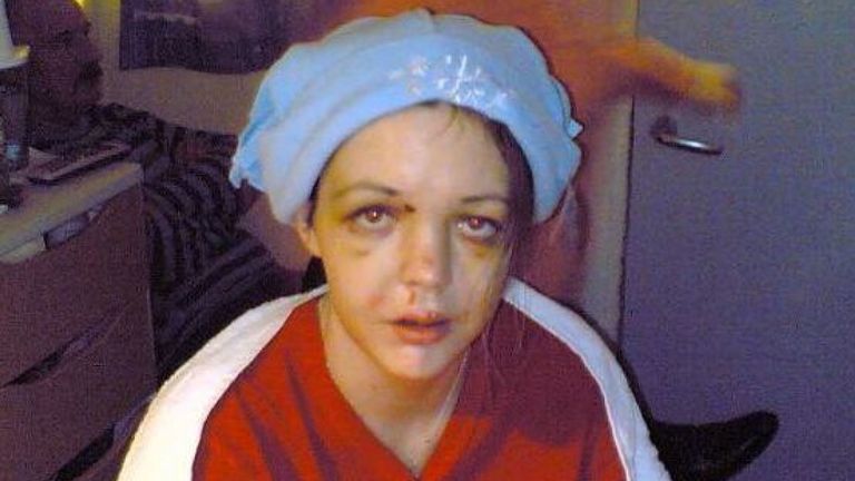 Gráinne après l'accident de 2006. Photo: Gráinne Kealy