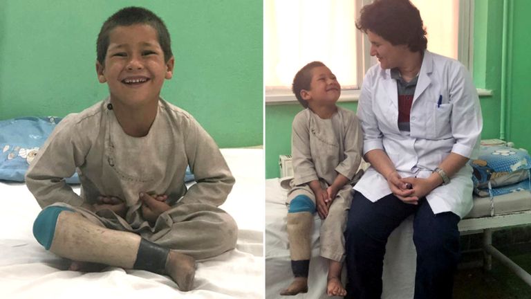 Un garçon afghan avec une jambe prothétique avec la kinésithérapeute Mulkara Rahimi
