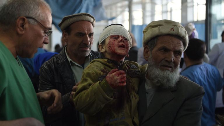 Un Afghan qui tient un enfant blessé après l'explosion d'une voiture piégée à Kaboul