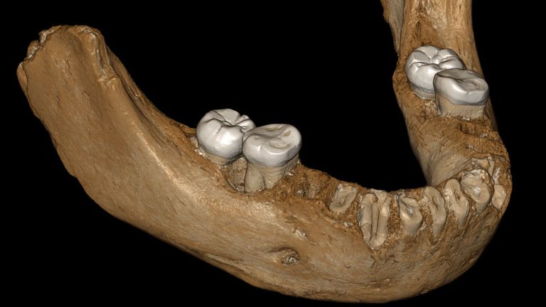 Une reconstruction virtuelle de la mâchoire de Denisovan