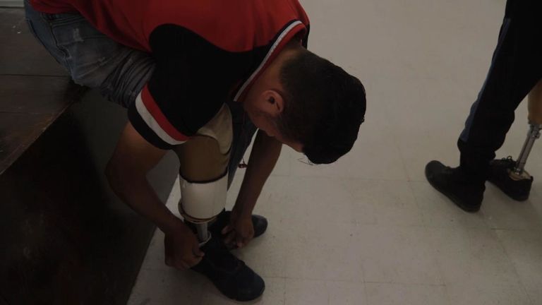 Mohammed, 17 ans, a été abattu par un tireur d’élite israélien en novembre dernier. Il apprend maintenant à marcher de nouveau.