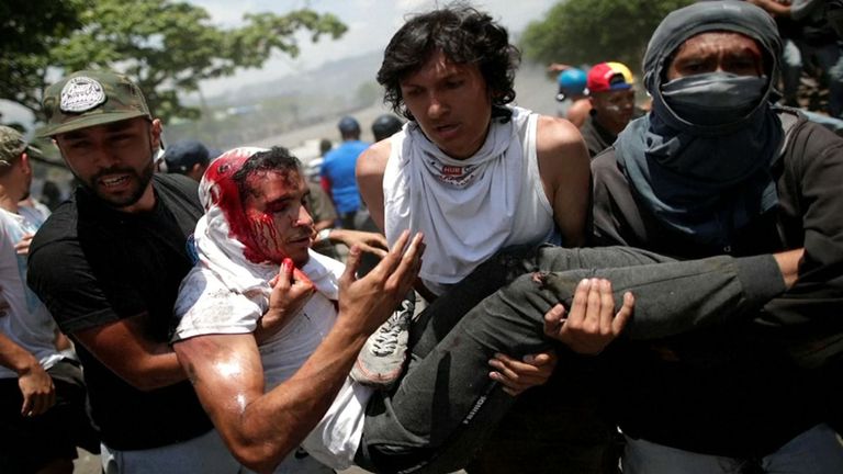 Luis Alejandro a été frappé par un véhicule blindé alors qu'il manifestait contre Nicolas Maduro à Caracas.