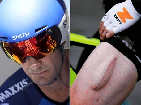 Photos: 'Quelqu'un peut-il me dire ce qui s'est passé ici?' – L'ancien cycliste Sky "développe un nouveau muscle quad"