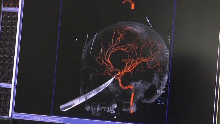 Le scanner cérébral d’Eli Gregg