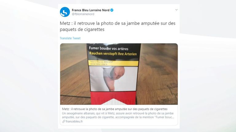 Les médias français rapportent que l'homme a perdu sa jambe lors d'une fusillade en 1997