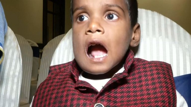 L'enfant de sept ans s'est plaint d'un gonflement de la bouche