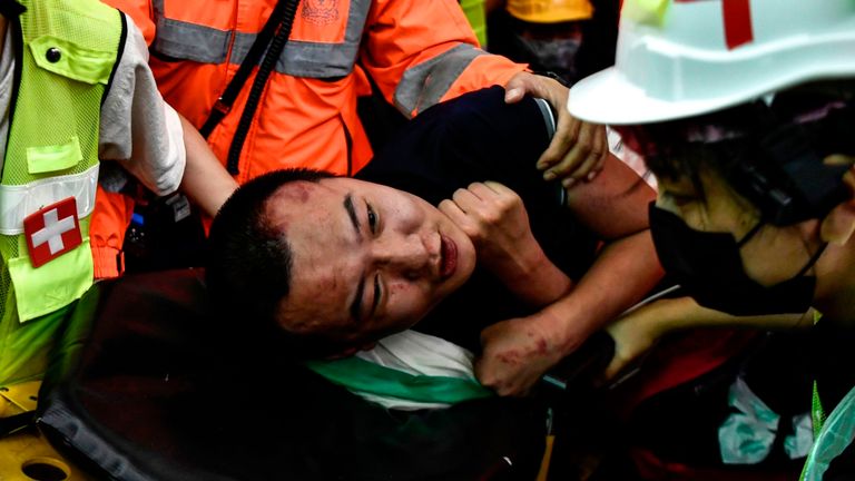 Un homme blessé est sauvé par des médecins