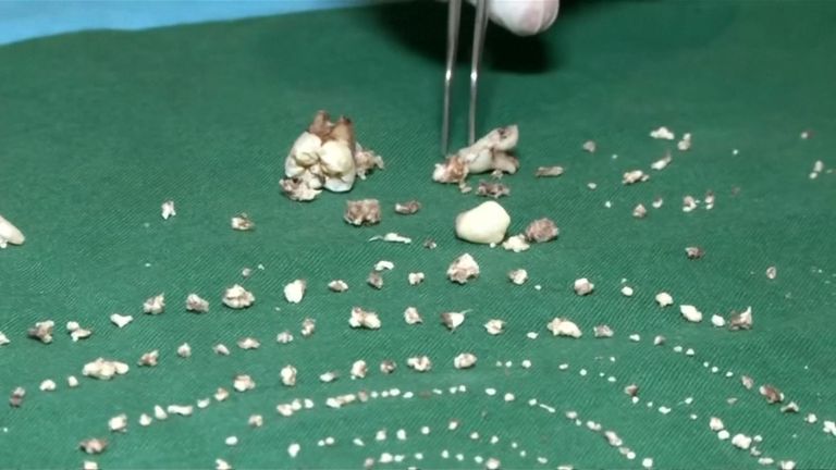 Les dents étaient de taille variable