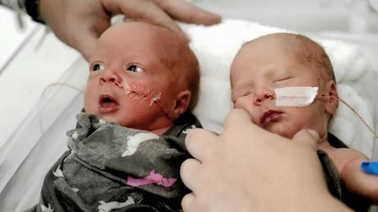 Emma et Addison sont nés à trois minutes d'intervalle. Pic: Centre médical régional du Piémont Athènes