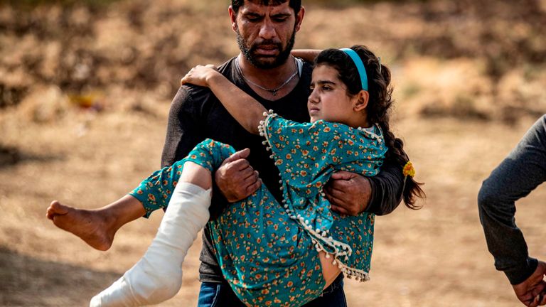 Une jeune syrienne blessée par les bombardements turcs sur Ras Al Ain est emmenée hors de l'hôpital