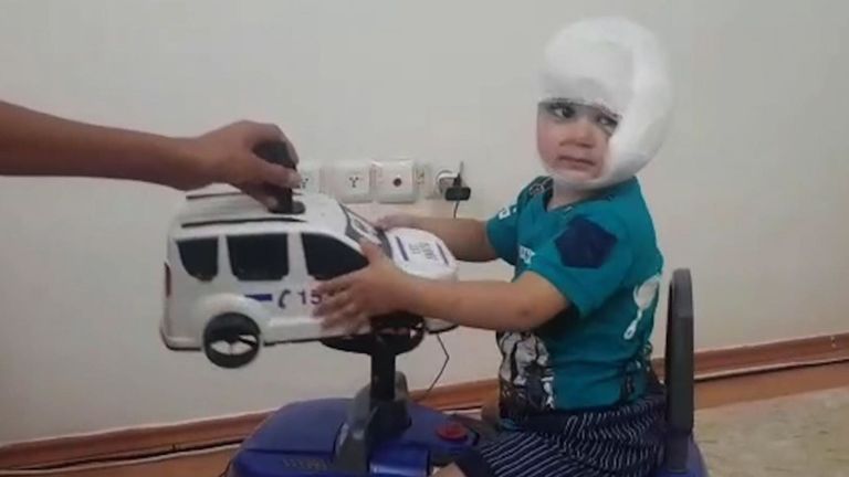 Ahmed est soigné dans un hôpital turc et est maintenant en état de jouer avec des jouets