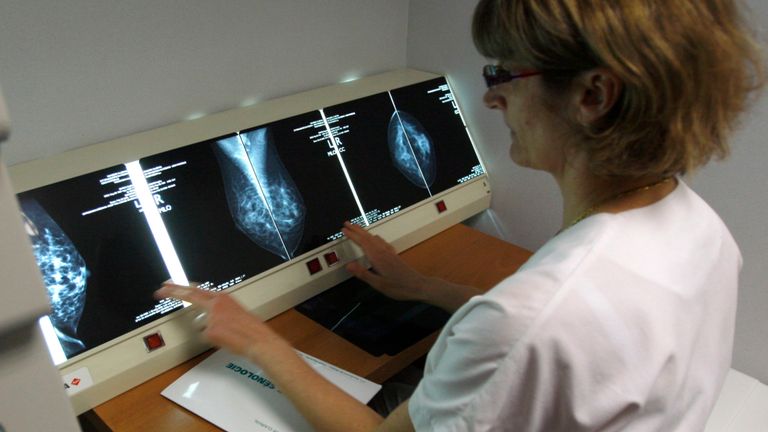 Un radiologue examine les radiographies des seins