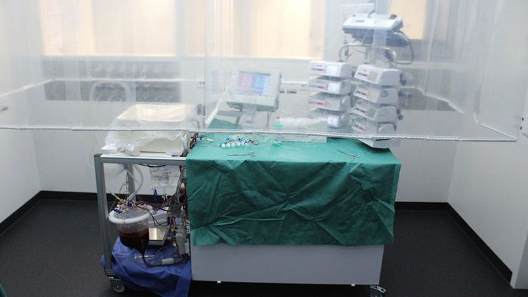 La perfusion pompe le sang à travers les vaisseaux de l'organe pour le faire fonctionner. Pic: USZ