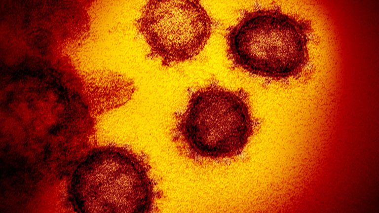 Des chercheurs américains ont produit des images de près du coronavirus 2019. Photo: NIAID-RML
