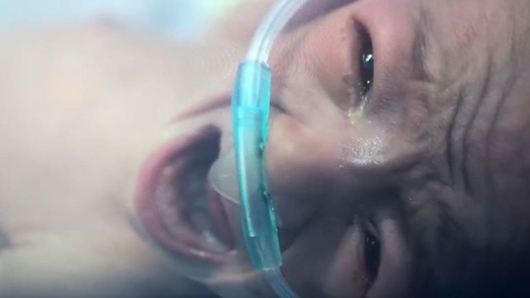 Un bébé pleure alors qu'elle est prise en charge dans un hôpital secret de la province d'Idlib en Syrie