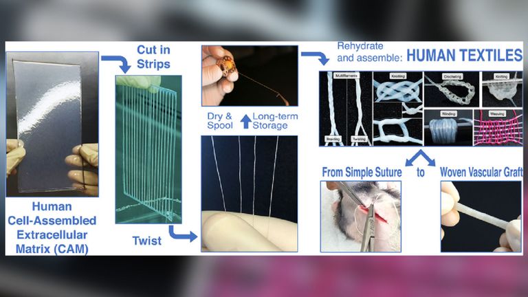 Comment le biomatériau est fabriqué et utilisé. Photo: Acta Biomaterialia / Elsevier
