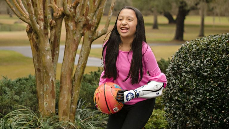 Bella Tadlock, 11 ans, qui a reçu un appel téléphonique de l'acteur de Star Wars Mark Hamill après avoir reçu un bras bionique dans le style R2-D2 d'Open Bionics