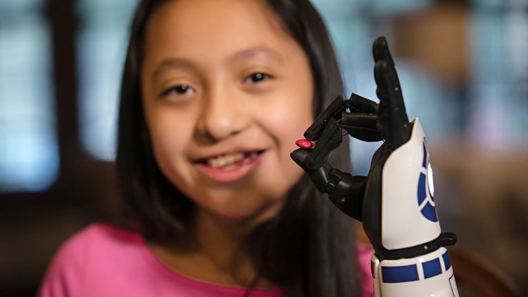 Bella Tadlock, amputée de 11 ans, qui a reçu un appel téléphonique de l'acteur de Star Wars Mark Hamill après avoir reçu un bras bionique dans le style de R2-D2 d'Open Bionics