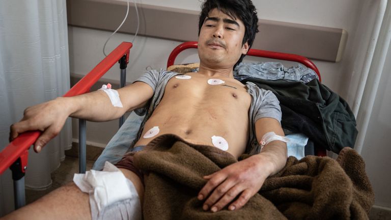 Un migrant d'Afghanistan se rétablit dans un hôpital turc après avoir été blessé à l'aine