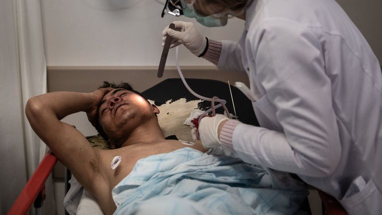 Un migrant d'Afghanistan se rétablit à l'hôpital après avoir été blessé à la tête 