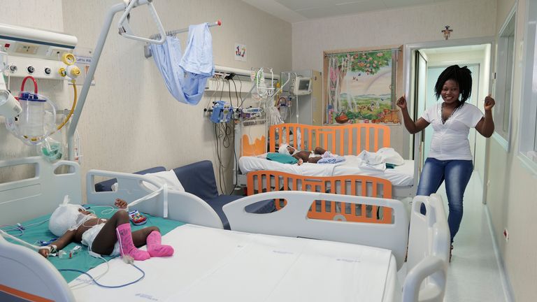 Aucune condition neurologique n'a été signalée après la séparation des jumeaux.  Photo: Hôpital pédiatrique Bambino Gesu