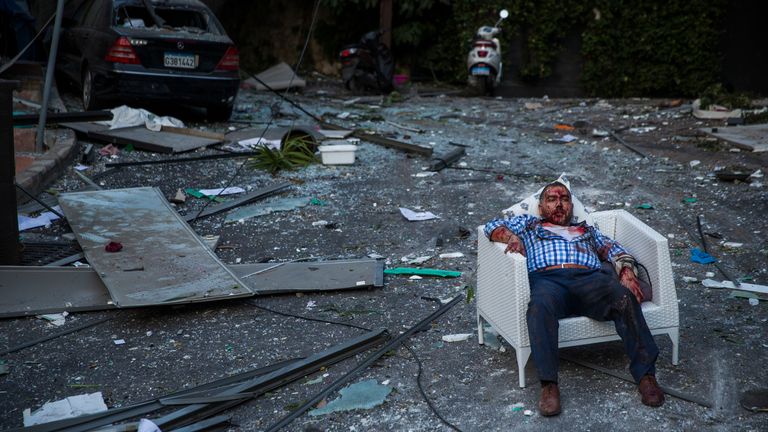 BEYROUTH, LIBAN - 04 AOÛT: Un homme blessé repose sur une chaise après une grande explosion le 4 août 2020 à Beyrouth, au Liban.  Une vidéo partagée sur les réseaux sociaux a montré un incendie de structure près du port de Beyrouth suivi d'une deuxième explosion massive, qui a endommagé les bâtiments environnants et blessé des centaines de personnes.  (Photo par Daniel Carde / Getty Images)