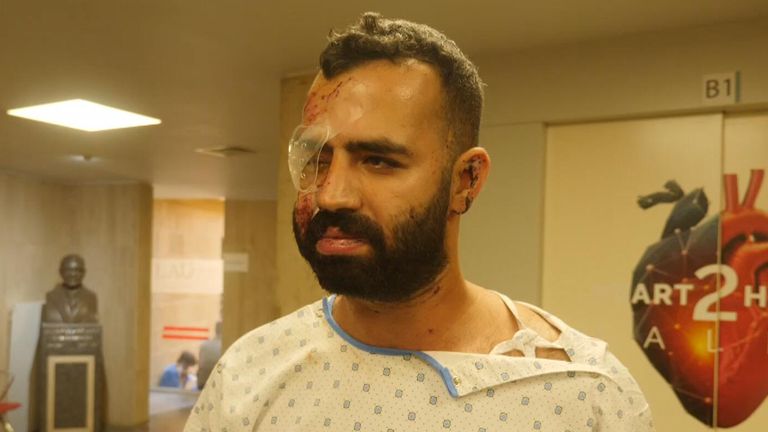 Victime d'une explosion à Beyrouth