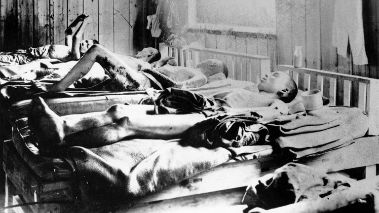 Les survivants de l'explosion souffrant du mal des radiations