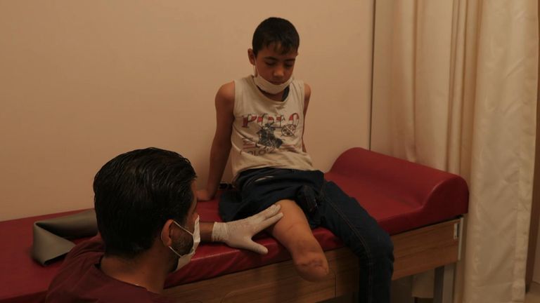 Abdul Rahman, neuf ans, a une jambe prothétique