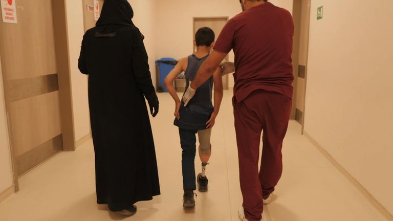 Abdul Rahman a maintenant une jambe prothétique