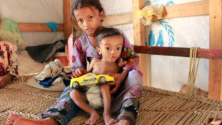 L'UNICEF dit que 10 millions d'enfants sont confrontés à la famine 